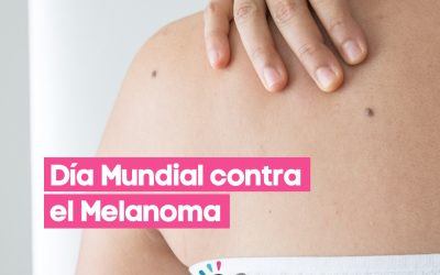 Dia mundial contra el melanoma