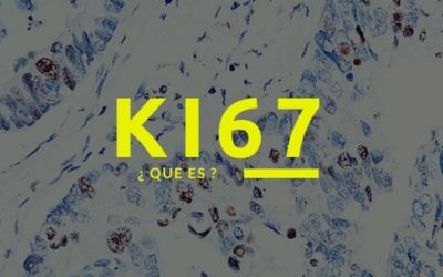 Ki67