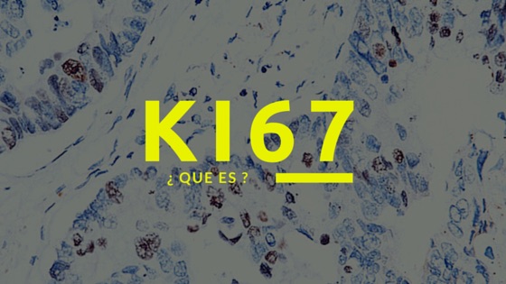 Ki67