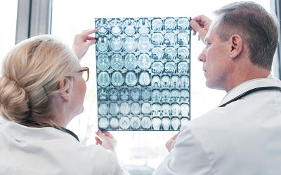 8 de junio: Día de los Tumores Cerebrales