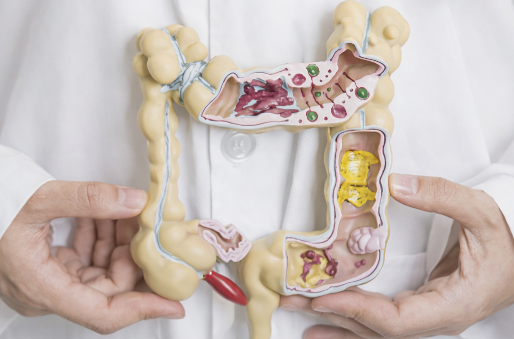 Día mundial del cáncer de colon