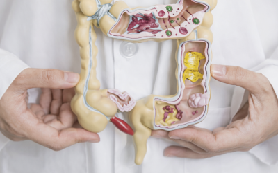 Día mundial del cáncer de colon